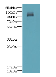 DENND2C Polyclonal Antibody
