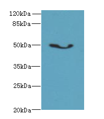 ADAL Polyclonal Antibody (100 µl)