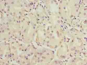 C6orf141 Polyclonal Antibody