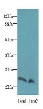 LGALS9C Polyclonal Antibody