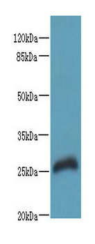 RTP2 Polyclonal Antibody