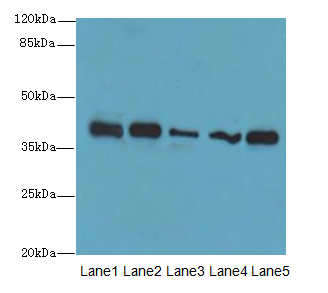 KHDRBS2 Polyclonal Antibody