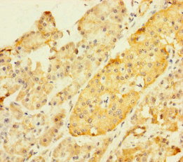 ZKSCAN2 Polyclonal Antibody