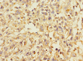 AVPI1 Polyclonal Antibody
