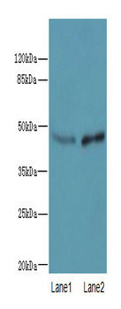 FAM69A Polyclonal Antibody