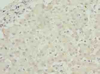 RPL7L1 Polyclonal Antibody