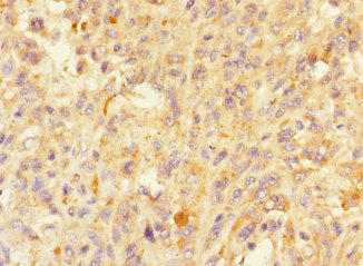 MORN5 Polyclonal Antibody