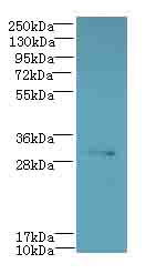 CYB5R2 Polyclonal Antibody