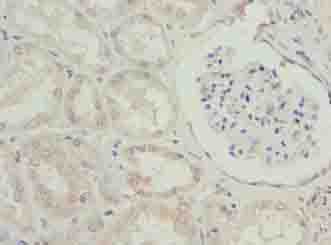 EFCAB12 Polyclonal Antibody