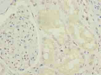 ENPP6 Polyclonal Antibody