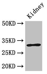 FAM151B Polyclonal Antibody