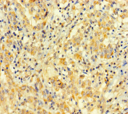 ARHGAP27 Polyclonal Antibody (50 µl)