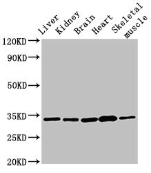 AHSA2 Polyclonal Antibody