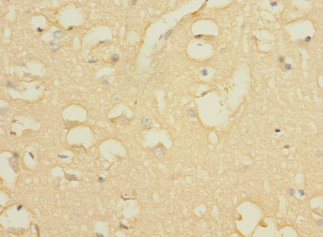 WBSCR17 Polyclonal Antibody