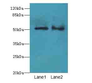 SLC30A6 Polyclonal Antibody