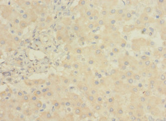 LRRC31 Polyclonal Antibody