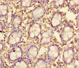 TMPRSS7 Polyclonal Antibody