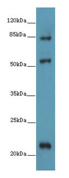 Western blot<br />All lanes: PYHIN1 Polyclonal Antibody at 6 ug/ml+Mouse small intestine tissue<br /> Goat polyclonal to rabbit at 1/10000 dilution<br />Predicted band size: 55 kDa<br />Observed band size: 55,22,84 kDa<br />