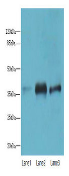 C5orf45 Polyclonal Antibody