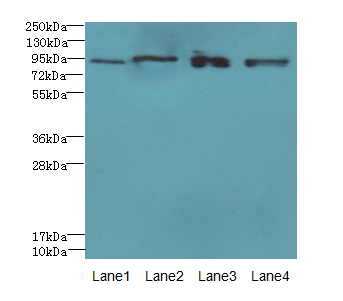 XRRA1 Polyclonal Antibody (100 µl)