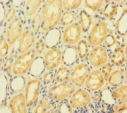 GRHL2 Polyclonal Antibody