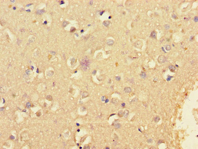 KCNIP4 Polyclonal Antibody