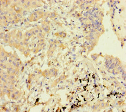 GBP6 Polyclonal Antibody