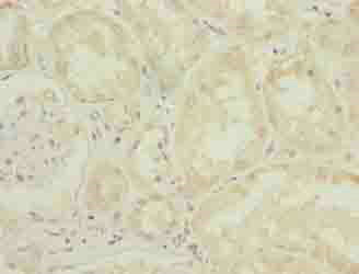 DPH6 Polyclonal Antibody