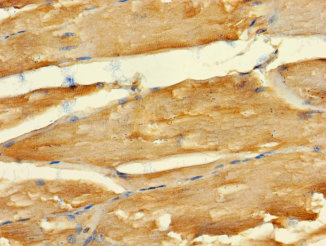 Immunohistochemistry of paraffin-embedded human skeletal muscle tissue using ABLIM2 Polyclonal Antibody at dilution 1:100