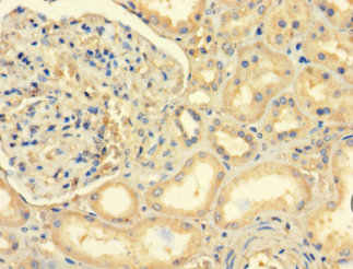 Immunohistochemistry of paraffin-embedded human kidney tissue using ABLIM2 Polyclonal Antibody at dilution 1:100