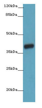OGFOD2 Polyclonal Antibody