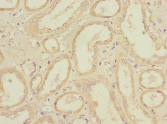 Immunohistochemistry of paraffin-embedded human kidney tissue REEP3 Polyclonal Antibody at dilution 1:100