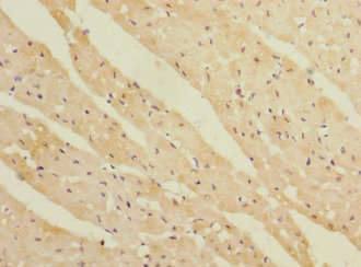 Immunohistochemistry of paraffin-embedded human heart tissue REEP3 Polyclonal Antibody at dilution 1:100