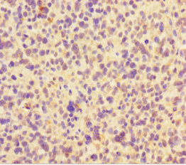 FAM117B Polyclonal Antibody