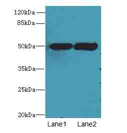 TUBA3E Polyclonal Antibody