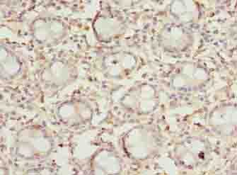 DENND5A Polyclonal Antibody