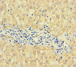 TPTE2 Polyclonal Antibody
