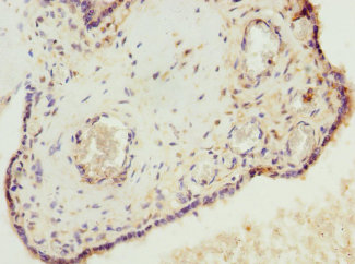 VHLL Polyclonal Antibody