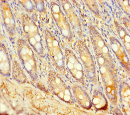 UGT2A3 Polyclonal Antibody