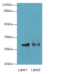 HACD2 Polyclonal Antibody