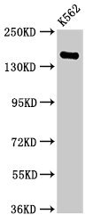 FGD6 Polyclonal Antibody