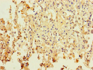 PAXIP1 Polyclonal Antibody