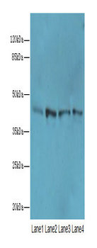 NAPEPLD Polyclonal Antibody