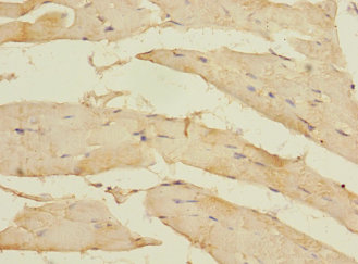 KIAA1161 Polyclonal Antibody