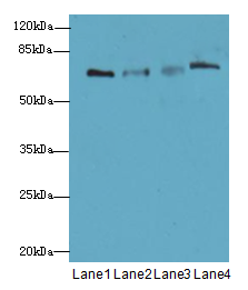PGM2L1 Polyclonal Antibody
