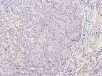 TRAT1 Polyclonal Antibody