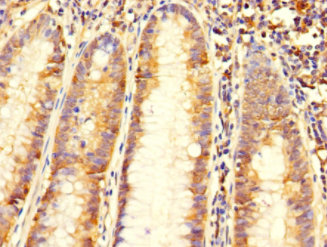 C6orf89 Polyclonal Antibody