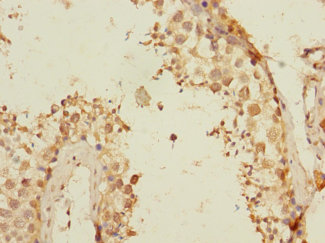 TEX43 Polyclonal Antibody