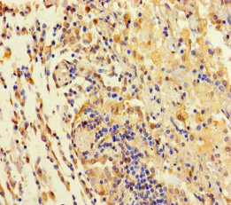 TAS2R42 Polyclonal Antibody