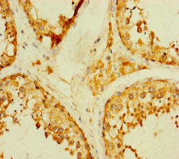 TADA2B Polyclonal Antibody (100 µl)